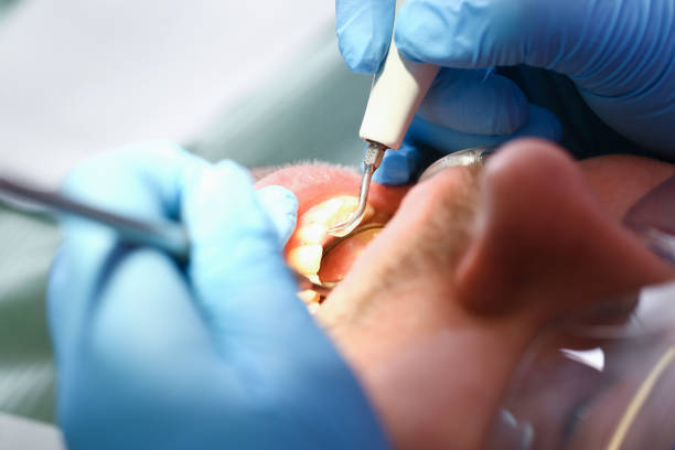 Best Root Canal Emergency Dentist  in Franklin, WI