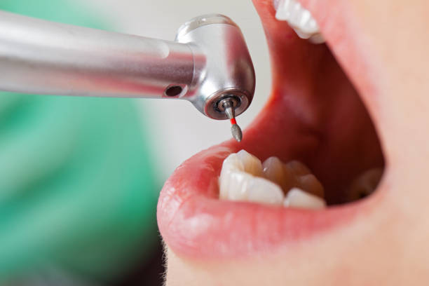Best Broken Tooth Emergency  in Franklin, WI